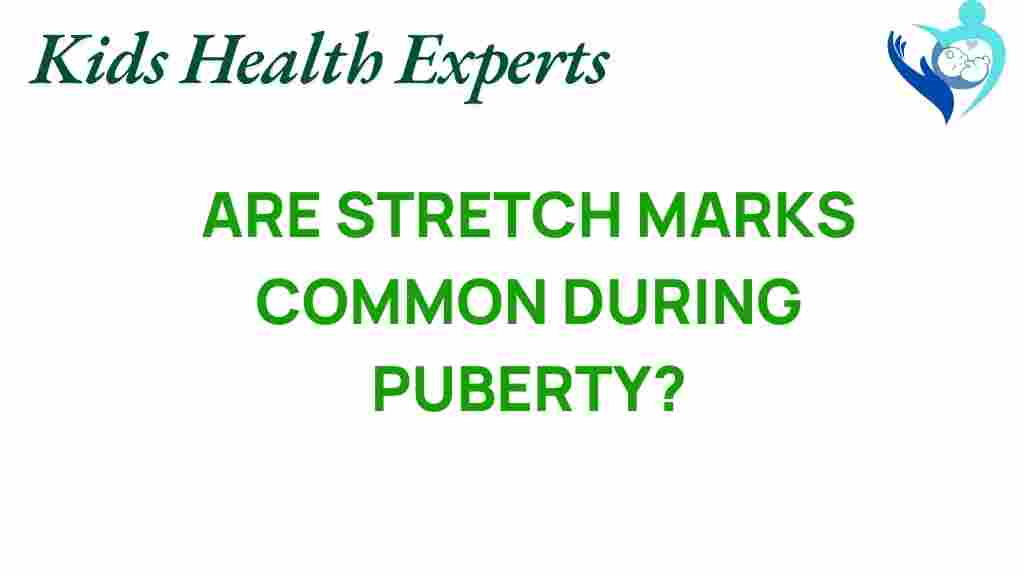 stretch-marks-puberty
